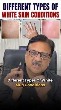 Different types of white skin conditions similar to Vitiligo. Expert advice by Dr Sandesh Gupta.