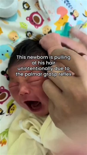 The Palmer grasp reflex is present in babies for the first few months after birth. It begins during pregnancy at some point late in the second trimester. So why does it happen? Some biologists have theorised that it has evolutionary origins. This reflex is mostly seen in furry primates, allowing the babies to grip onto the fur of their mother's. Our ancesters were once hairy, so perhaps there's some weight to the theory. From around 4 months onwards, babies' fine motor skills develop as they sta