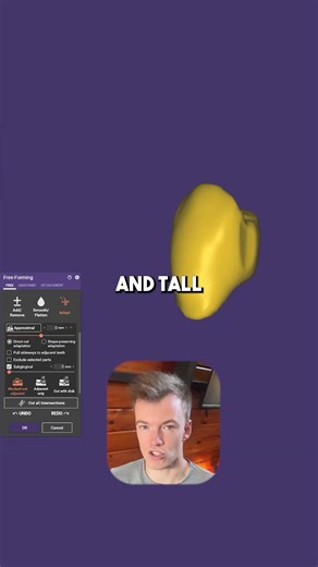 Here's how to use the Aproximal Setting correctly in exocad