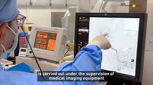 【Modern Cancer Hospital— Minimally Invasive Technology Series — Interventional Therapy】 Compared to traditional intravenous chemotherapy💉, interventional therapy offers advantages such as being minimally invasive🩹, achieving drug concentrations tens of times higher📈, and having fewer side effects😊. By directly targeting tumor tissue🎯, interventional therapy effectively destroys cancer cells💥, providing better outcomes and improved quality of life for patients🌈. 🔔 Want to be the first to 