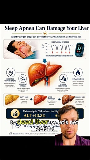 Here's what your doctor should have told you about sleep apnea and your liver here