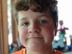 Research Areas - Childhood Cancer