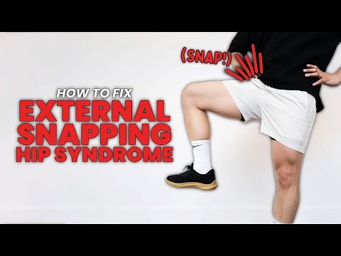 External Snapping Hip Syndrome