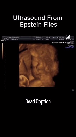 I’ve been able to determine additional details about the woman seen in the ultrasound, and her path into Jeffrey Epstein’s orbit appears to trace back to a recruitment pipeline out of Ukraine. Two sisters. Recruited together. But their paths would take very different turns. Both were placed into language and cultural training through LSI and Berlitz, programs Epstein routinely used as part of his recruitment and placement system. Yana appeared to accept the arrangement. She was given education, 