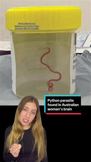 Australian Woman with Parasite from Python in Brain