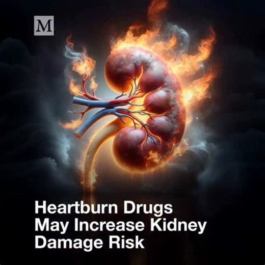 Long-term use of Proton Pump Inhibitors (PPIs) is linked to a higher risk of kidney damage through several potential pathways: ​Key Risks ​Acute Interstitial Nephritis (AIN): This is an immune-mediated reaction where the kidney tubules become inflamed. It is often "silent," meaning it can occur without obvious symptoms until significant damage is done. ​Chronic Kidney Disease (CKD): Observational studies suggest long-term users have a 20% to 50% higher risk of developing CKD compared to non-user