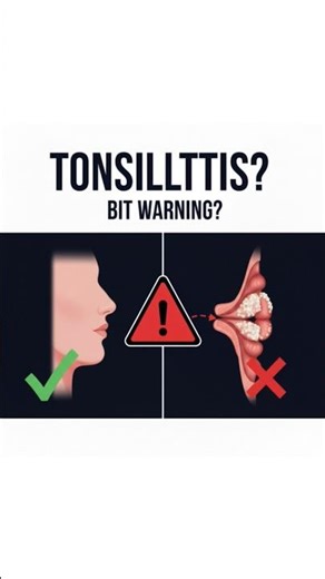 “Sore throat… or something worse?” #tonsilitis #medical