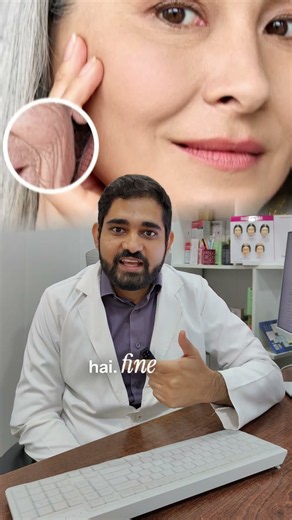 Vampire Facial Explained | Does PRP Actually Improve Skin? | Dermatologist Explains