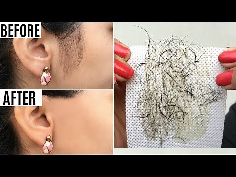 Instant FACE Hair Removal - 10 Ways to PERMANENTLY Get Rid of Face/Body Hair | Anaysa