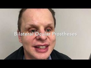 Bilateral Artificial Eyes for Real Life Faces Clinic Patient