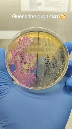 93K views · 1K reactions | Microbiology | Lab life | Facebook