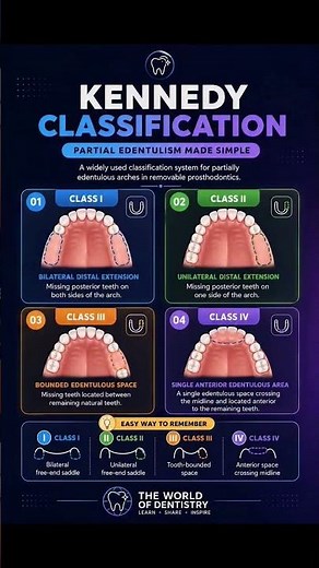🦷 Kennedy Classification Made Simple | The Foundation of Partial Denture Design #dental