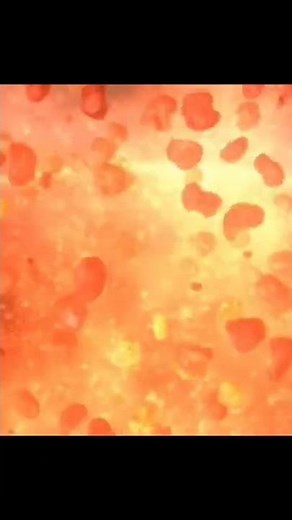 Explosion Meme [BEST MEMES No.5]