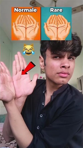 Normal vs Rare Palm Test 🤯 99% Are Normal! #shorts #cat