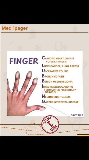 Clubbing Mnemonic: Causes Every Med Student Should Know