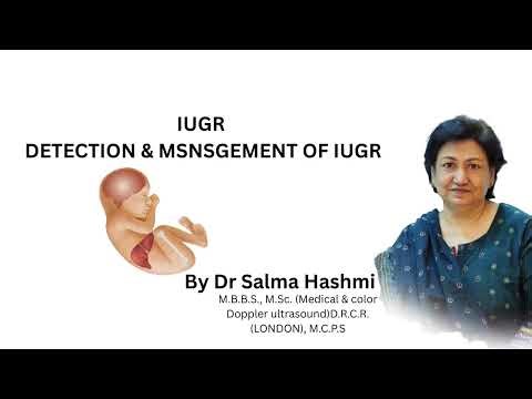 Role of Color Doppler in detection & management of IUGR