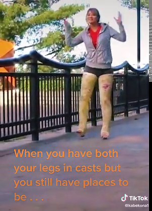 Emily's Funny Full Leg Cast Mishap