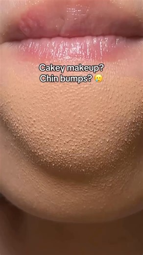 milkydew ♡ NYC Beauty on Instagram: "No more cakey makeup & chin bumps🤍 @mixsoon_usa #mixsoonbeanessence #koreanskincare #skincareroutine #glassskin #amazon #makeuptips #clearskin #skincaretips #mixsoon"