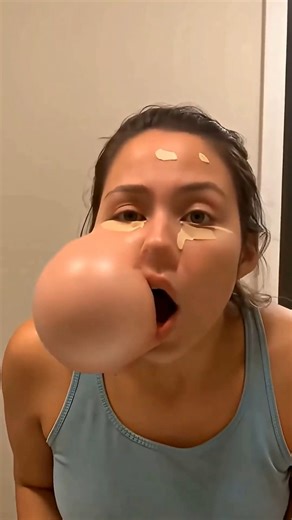 وراء انتفاخ وجهها.. سبب صادم 😪😱 #شفا #قصص #قصص_واقعية #حكمة #قصص_اطفال