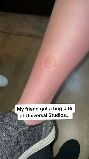 Watch the full video to hear their reaction - woah! 💚 #itsathing #bugbitething #bugbiterelief