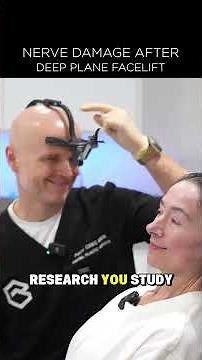 Nerve damage after deep plane facelift Iteration