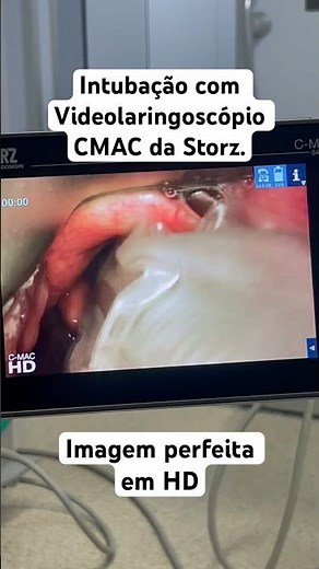 Intubação com o C- MAC: Videolaringoscópio !! #intubation #cmac #videolaringoscopio