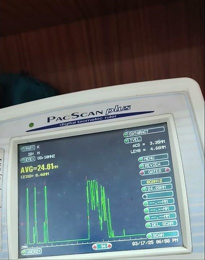 A scan biometry procedure