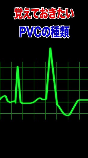 PVCの種類を理解しよう！心電図入門