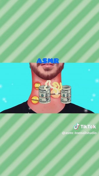 Healthy nails, 💅 ASMR 💖#ToenailTreatment #asmr #TransformationVideo #SatisfyingVideo