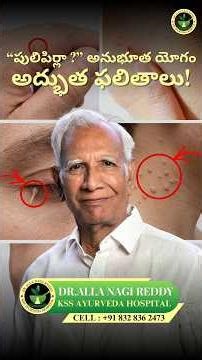 పులిపిర్లా ? అనుభూత యోగం. అద్భుత ఫలితాలు!" #ayurveda #skintreatment #natural