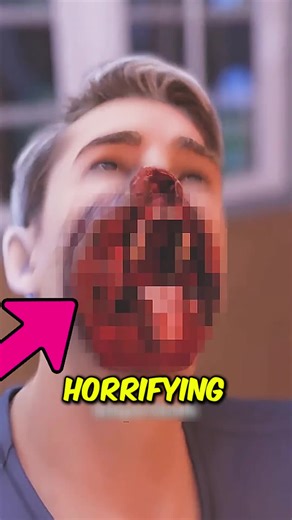 Unimaginable Accidents Leading to Real Deaths