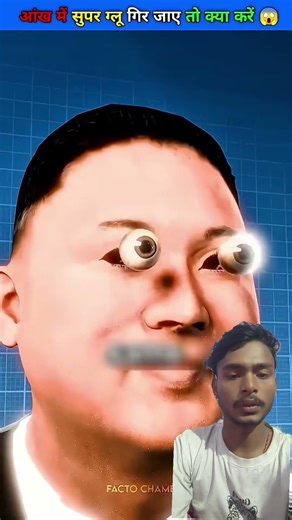 Accidentally Got Super Glue in Your Eye What to Do? 😱 #facts #guess