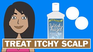 How To Clean Your Scalp With Witch Hazel