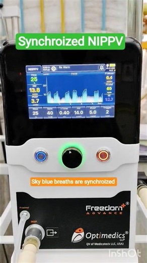 Synchroized NIPPV #youtubeshorts #shorts #optimedics