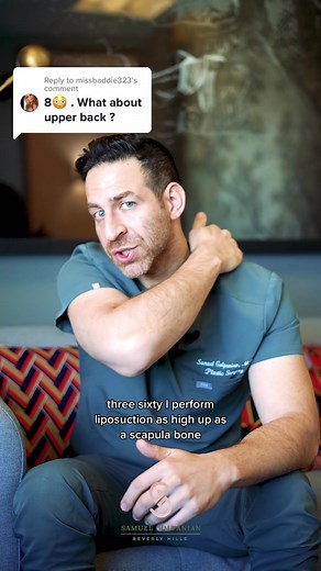 Replying to @missbaddie323 the upper back is included in the 8 areas! #lipo360 #fypシ #fyp #liposuction #plasticsurgeon