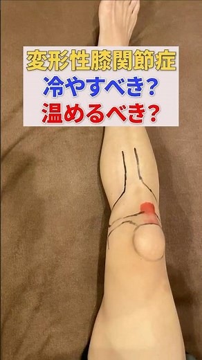 [If you're not sure, read this!] Should I apply cold or heat when my knee hurts? Osteoarthritis