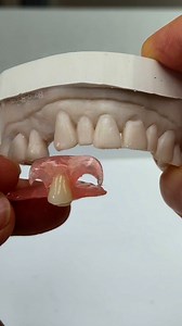 Longer extension on to #3 to prevent Choking! Dr.Janice Hong in California | Luke Kahng