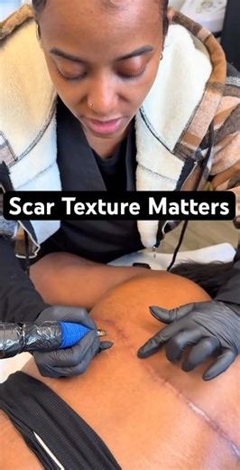 Adjusting Pressure for Thick Scar Tissue | Paramedical Tattoo Training