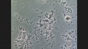 1970s Single Cell Organisms Swim Liquid Stock Footage Video (100% Royalty-free) 1008117649 | Shutterstock
