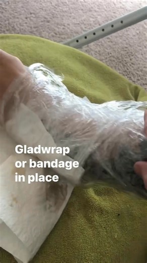 Make a COMFREY POULTICE for BROKEN BONES #survival #foraging #herbalmedicine #firstaid #herbalremedies #gardening #prepper #traditional | Prepper Kiwi