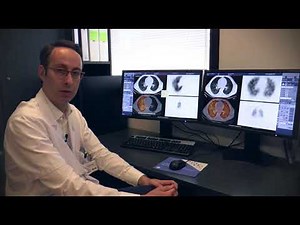 Scintiscanner pulmonaire Vidéo