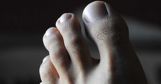 Ce signe visible sur vos orteils pourrait révéler un taux de cholestérol élevé !
