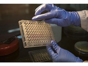 Life Sciences Firm Abcam Gets Takeover Approaches While It Battles Founder