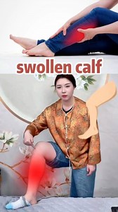 swollen calf #tcm #fyp | Dr. Taichi