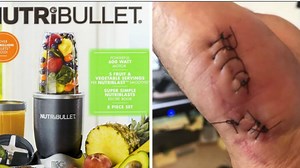 NutriBullet owners claim devices 'burst;' caused severe burns and cuts