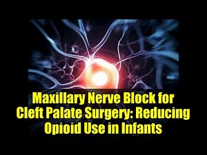 Maxillary Nerve Block for Cleft Palate Surgery: Reducing Opioid Use in Infants