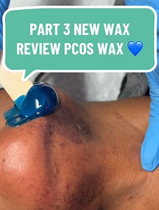 1M views · 6.6K reactions | PART 3: NEW WAX REVIEW & PCOS FACE WAX 珞 KoluaWax Bikini Babe wax is now an #amazonfavorites and must try! #fyp #esthetician #foryoupagе #viralvideo #amazon #athomewaxing #wax #reviews #koluawax #pcos #hirsutism #trending | Waxing Queen | Facebook