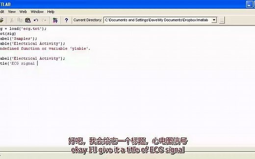 使用 Matlab 进行信号分析 - 心率示例