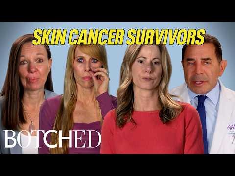 Skin Cancer Survivors: Self-Surgery, Rare Diagnoses, Lip Loss and More (Compilation) | Botched | E!