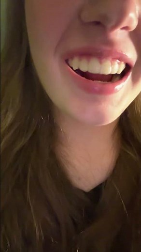 Retainer lisp 😬#hygiene #retainer #dentalcare #vent #helpmemakethismakesense